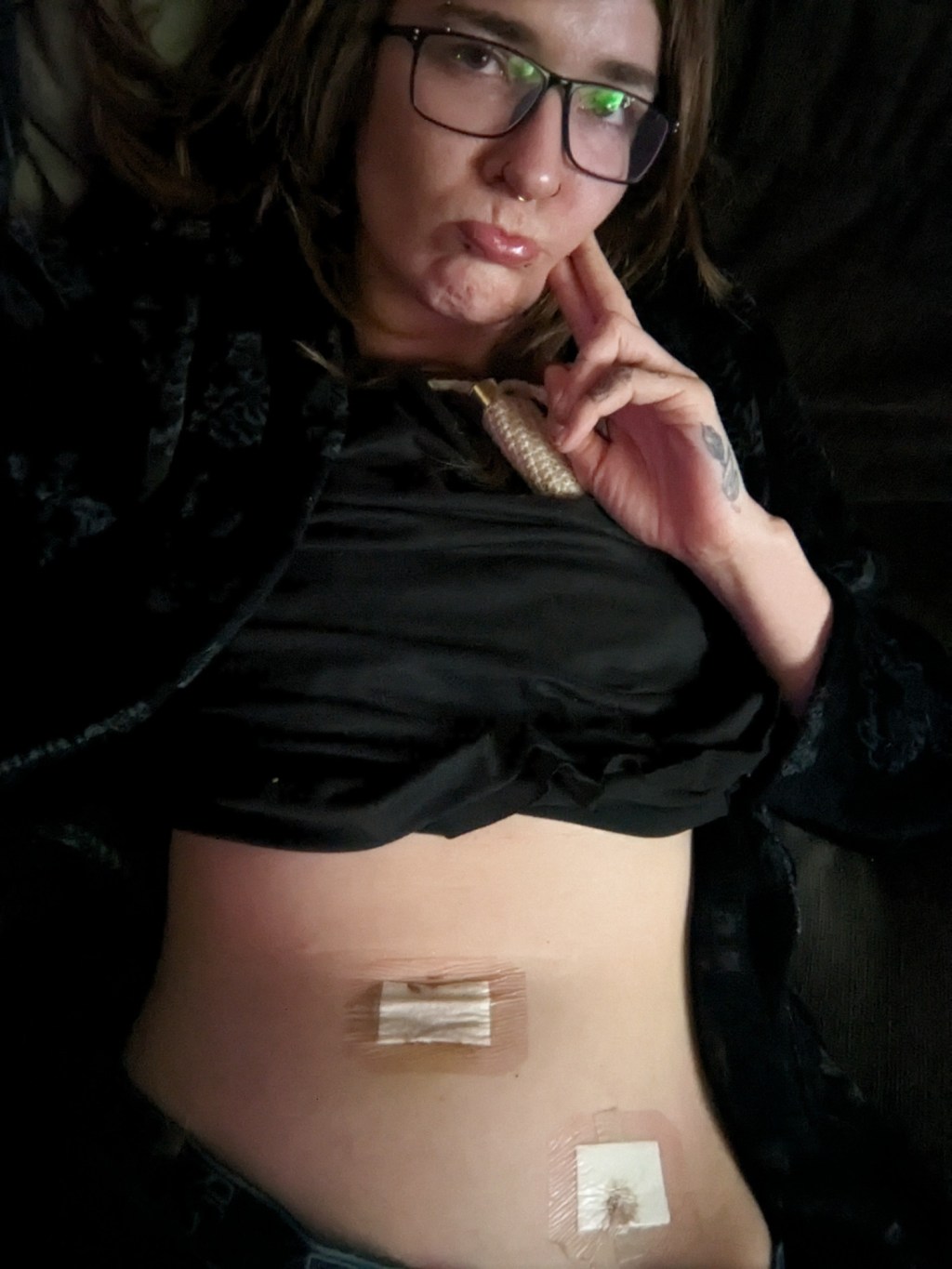 1 Week Post&nbsp;Operatie